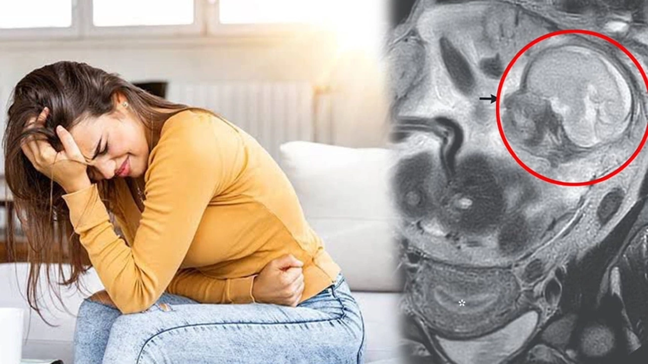 Bağırsakta büyüyen bebek tıp dünyasını şoke etti!