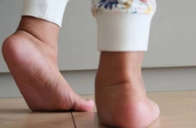 Çocuklarda içe basmanın 5 nedeni!